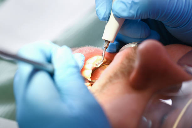 Best Emergency Dental Care for Sports Injuries in Beverly Hills, MI